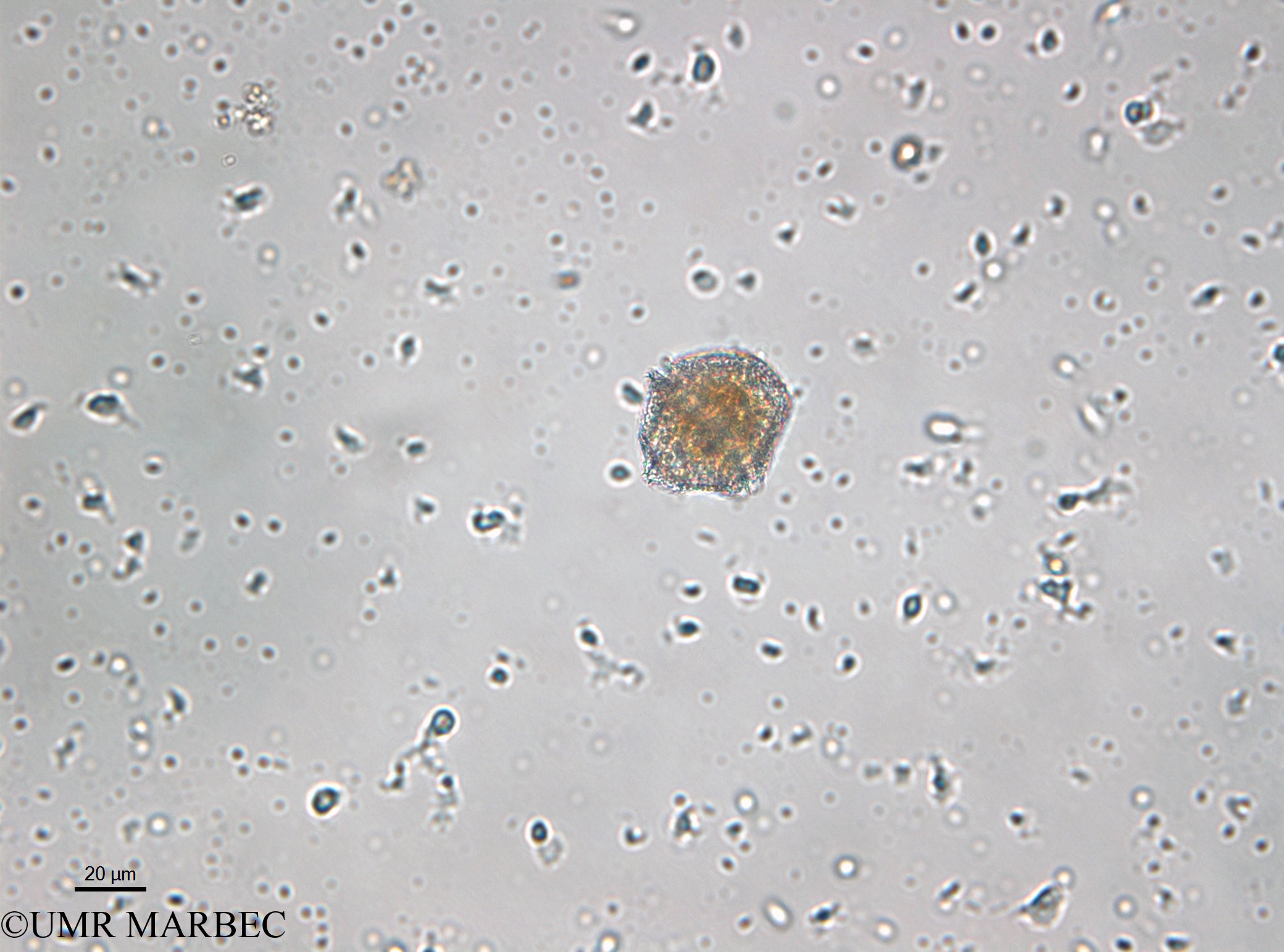 phyto/Bizerte/bizerte_lagoon/RISCO April 2014/Lingulodinium polyedrum (old Protoceratium reticulatum syn. Gonyaulax grindleyi - 140730_001_ovl-3)(copy).jpg